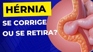 Como é a CIRURGIA DE HÉRNIA A hérnia é retirada [upl. by Eittod]