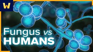 What Is Fungus and How Do Fungal Infections Happen  An Introduction to Infectious Diseases [upl. by Dolorita]