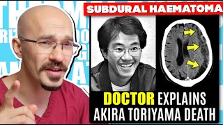 DOCTOR Explains Akira Toriyamas Death  Subdural Haematoma Explained [upl. by Mossolb]