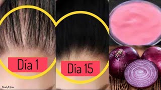 Jugo de Cebolla para la Caída del Cabello y Crecimiento [upl. by Eidissac]