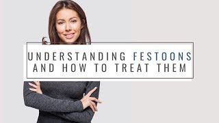 Understanding Festoons and How They Can Be Treated  Verso Surgery Centre [upl. by Pritchard]