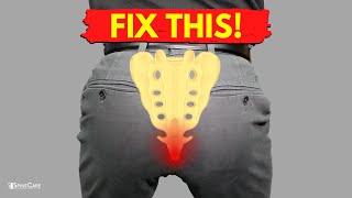 How to Fix Tailbone Pain for Good [upl. by Marashio]