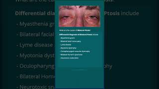 Ptosis Differentials [upl. by Gupta]