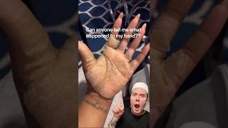 CRAZY HAND PEELING😱 follow for more💗 skincareroutine skincaretips skin beautytips [upl. by Ball]