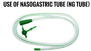 Use of nasogastric tube NG tube by Kshitij Foundation Chhindwara [upl. by Sidon]