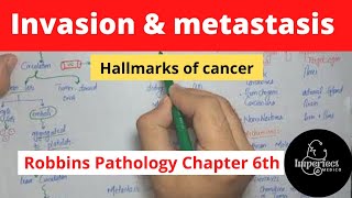 Invasion and Metastasis Hallmarks of CancerRobbins pathology chapter 6Neoplasiarobbinspathology [upl. by Landri286]