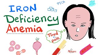 Iron Deficiency Anemia  All you need to know  Causes Symptoms Diagnosis Treatment [upl. by Esdnil]