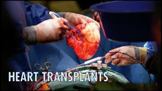 The Journey of Heart Transplants From Discovery to Procedure [upl. by Ander160]