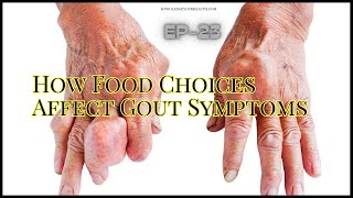 Food vs Gout What to Eat and Avoid EP23 [upl. by Hildie]