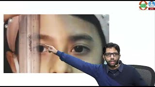 Ptosis IN TOTO Ophthalmology by Dr Sourabh Sharma [upl. by Auburta]