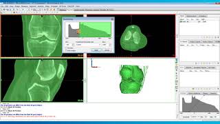 How to Perform Thresholding in Mimics  Mimics Innovation Suite  Materialise Medical [upl. by Enayr]