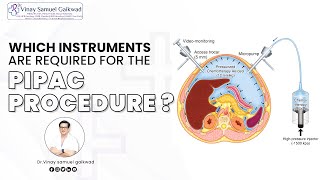 Which Instruments Are Required For the PIPAC Procedure  Dr Vinay Samuel Gaikwad cancer PIPAC [upl. by Awhsoj817]