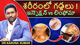 Lumps in Armpits and Neck Telugu  Dr Karuna Kumar [upl. by Ursulina929]