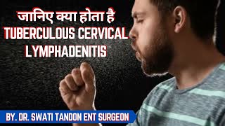 जानिए क्या होता है Tuberculous Cervical Lymphadenitis  By Dr Swati Tandon ENT Surgeon [upl. by Namhcan]