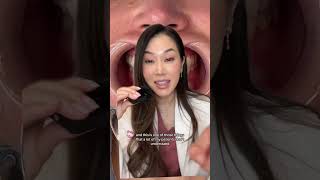 Do I have veneers veneers veneersmile smilemakeover dentist whiteteeth [upl. by Bern860]