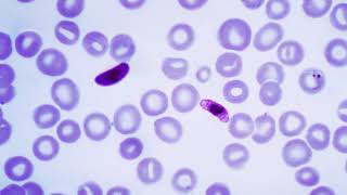 Plasmodium falciparum biology  Wikipedia audio article [upl. by Ronal]