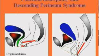 Anatomy of the pudendal nerve diagnosis and causes of pudendal neuropathy [upl. by Aneeb723]