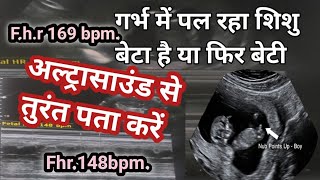 Ultrasound se jane ladka ya ladki baby boy symptoms during pregnancy symptoms of baby boy babygender [upl. by Patin]