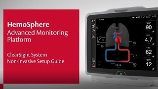 Noninvasive ClearSight System setup on the HemoSphere monitor [upl. by Dawkins]