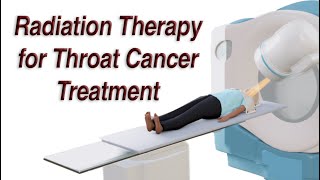 Throat Cancer Treatment with Radiation Therapy  Short Version [upl. by Tingey]