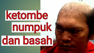 KETOMBE TERBANYAK basah PANGKAS RAMBUT [upl. by Ssegrub]