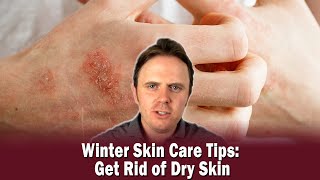 Winter Skin Care Tips Get Rid of Dry Skin  Podcast 320 [upl. by Anilat604]