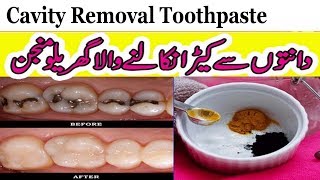 Tooth Care In UrduHindi  Homemade Cavity Removal Toothpaste  Anam Home Remedy [upl. by Tnilf]