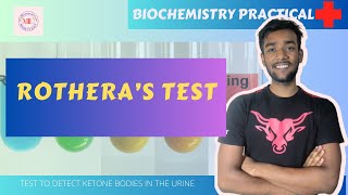 Rotheras Test URINE TEST FOR KETONE BODIES  BIOCHEMISTRY PRACTICAL with viva questions [upl. by Carmelo201]