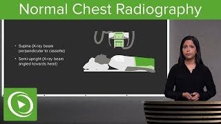 Normal Chest Radiography – Radiology  Lecturio [upl. by Yrevi]