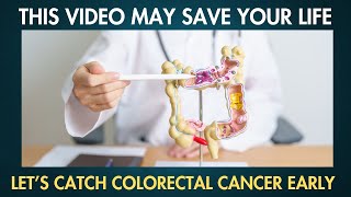 11 Early Signs of Colorectal Cancer that you SHOULDN’T IGNORE [upl. by Chesney]