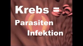 Dr Weber  1970  KREBS und Parasiten Infektionen  Selbsttest und Anleitung [upl. by Eitsirk]