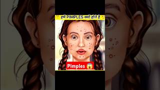 Why do pimples occur on face 🤔  PIMPLES  shorts short [upl. by Rider]