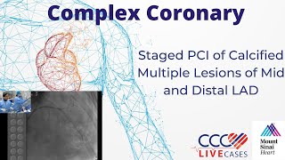 Staged PCI of Calcified Multiple Lesions of Mid and Distal LAD  February 17 2015 Webcast [upl. by Mailliwnhoj]