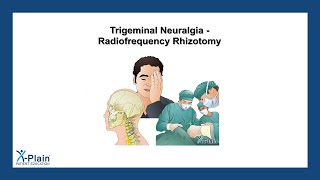 Trigeminal Neuralgia  Radiofrequency Rhizotomy [upl. by Irpac146]