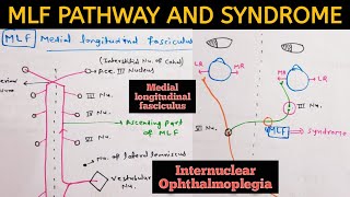 Medial Longitudinal FasciculusMLF  Pathway and MLF Syndrome  Internuclear ophthalmoplegia INO [upl. by Ecallaw399]