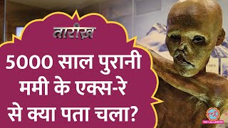 5000 साल पुरानी Mummy के एक्सरे से क्या पता चला  Otzi the Iceman  Tarikh E555 [upl. by Esyla594]