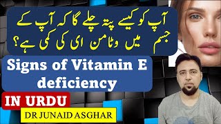 Signs of Vitamin E Deficiency  Vitamin of Youth  Dr Junaid Asghar [upl. by Schiff276]