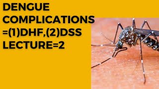 Dengue complications DHF and DSS lectures 2 [upl. by Eleazar25]