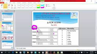 intracranial hemorrhage by Dr Marwa Elshazly [upl. by Champ282]