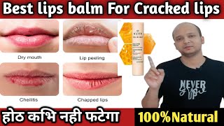 Best Lip Balm For Dry Cracked And Chapped Lips🤩 [upl. by Lynnett]