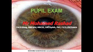 5 Steps of Pupil examination [upl. by Colinson]