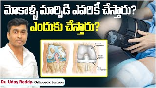 Knee Replacement Surgery Recovery  Who Needs Knee Replacement Surgery  Importance of Physiotherapy [upl. by Oni]