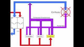 Portocaval Anastomoses [upl. by Nylsirhc45]