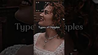 Types of Dimples🌟 dimples beauty naturalbeauty aestheticlifestyle viralytshorts [upl. by Idet550]