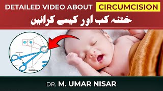 Detail video about Circumcision in Children  When and How to do it [upl. by Olegnad]