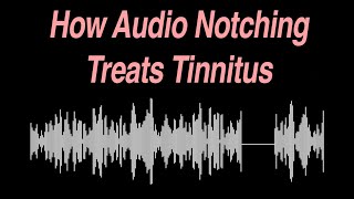 How Audio Notching Treats Tinnitus [upl. by Yrtneg]