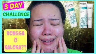 Ponds Acne Clear  3 Day Challenge on Acne Prone Skin  Bongga O Kaloka [upl. by Gertrudis]