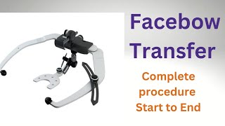 Facebow Transfer procedure start to End [upl. by Ylirama]