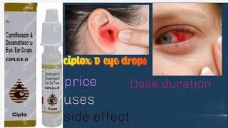 ciplox D eyes and ear drops ka istemal [upl. by Elazaro608]