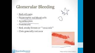 Glomerulonephritis principles [upl. by Dianuj]